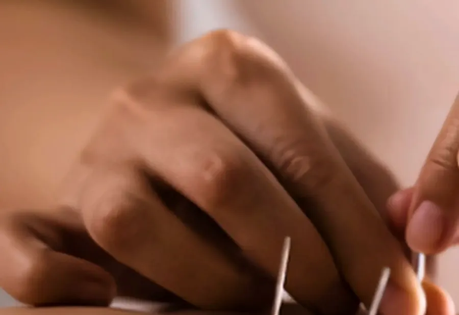 Tratamento integrativo: acupuntura e massagem ayurveda no HomYoga